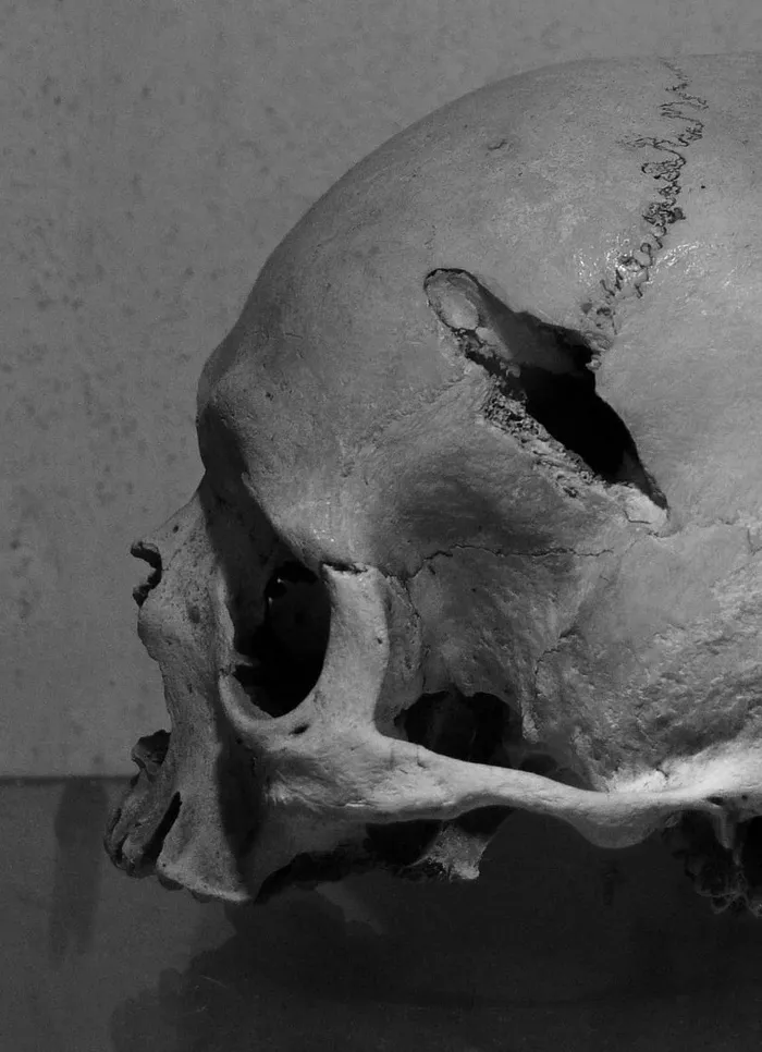 头骨，骨头，头，康斯坦斯，头骨，骨头，缺白，摄影，