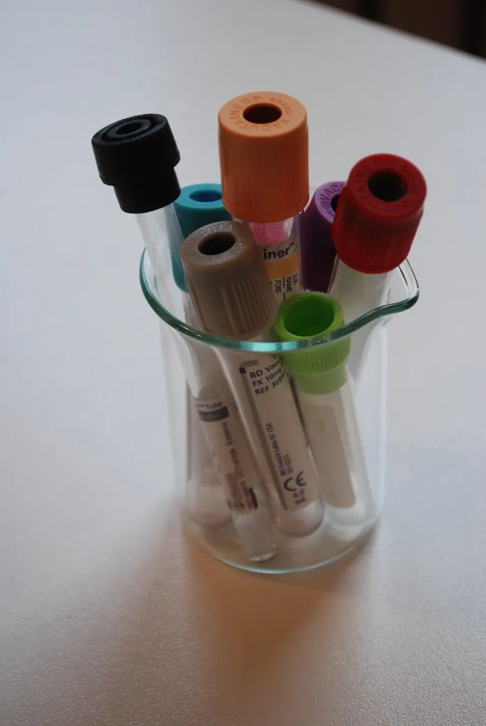 各种彩色玻璃容器，实验室，医疗，实验室，诊断，血液，试管，手套