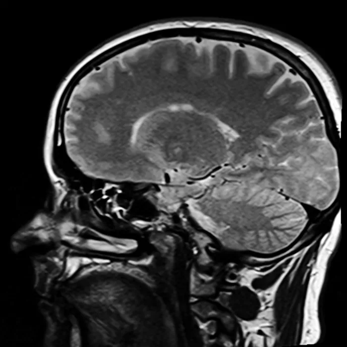 人头 x 射线, 头, 磁共振成像, mrt, x 射线, x 射线图像, 大脑, 医疗保健和医学
