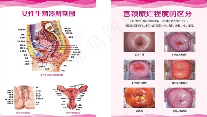 宫颈图 女性解剖图图片
