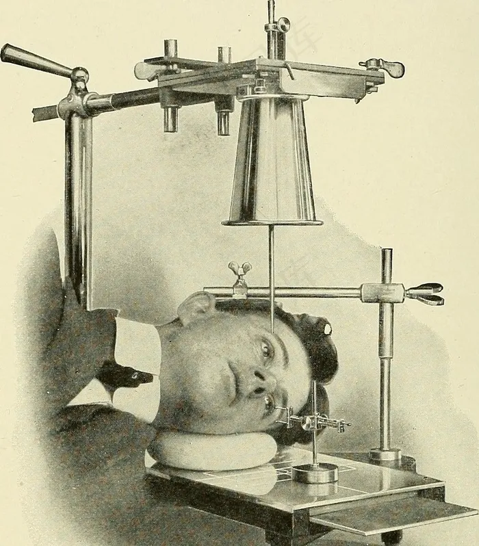 图片来自“实用的电疗和X射线疗法：有关光疗，眼科手术中的X射线，牙科方面的X射线以及X射线的法医学方面的内容”的第397页，”（1912年）