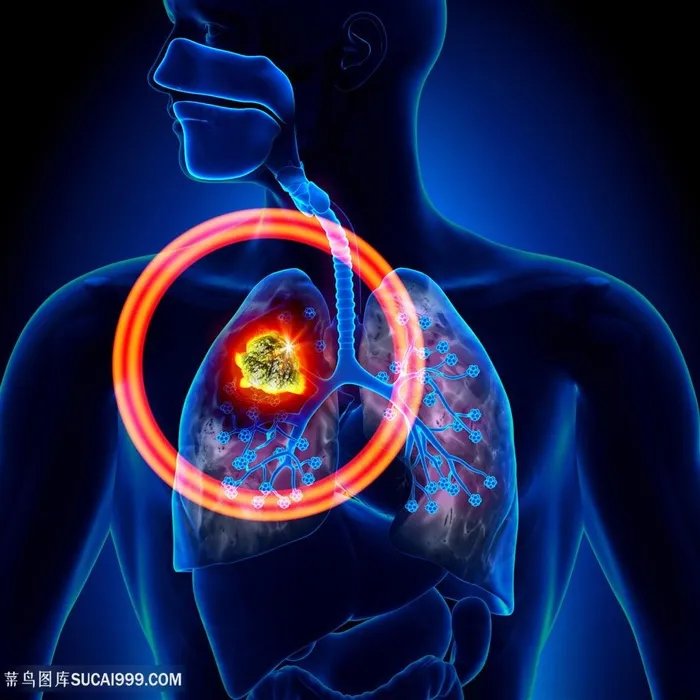 人体器官肺部结实透视图片人体器官图