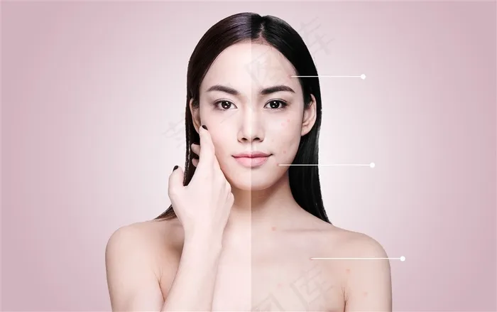 美容皮肤问题宣传广告美容图片