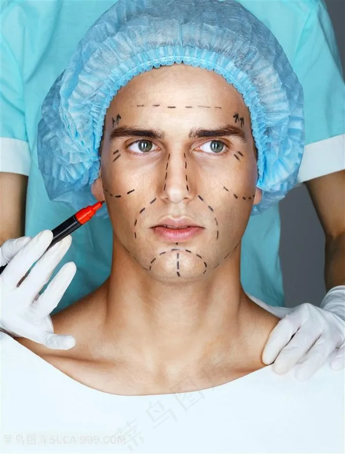 男士脸部画线准备做手术图片