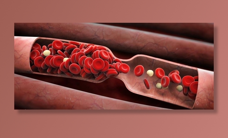 血管血小板图片