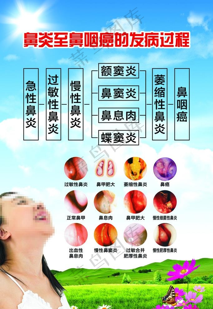 鼻炎宣传海报图片